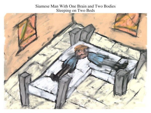 Siamese Man With One Brain and Two Bodies Sleeping on Two Beds