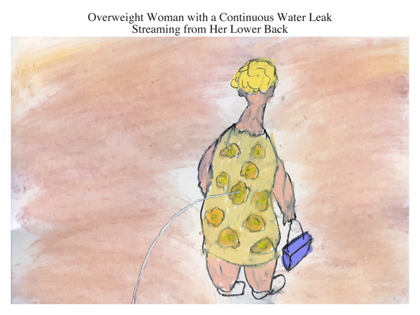 Overweight Woman with a Continuous Water Leak Streaming from Her Lower Back