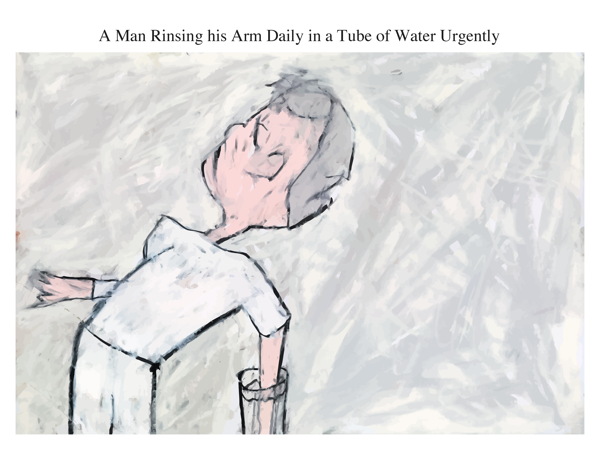 A Man Rinsing his Arm Daily in a Tube of Water Urgently