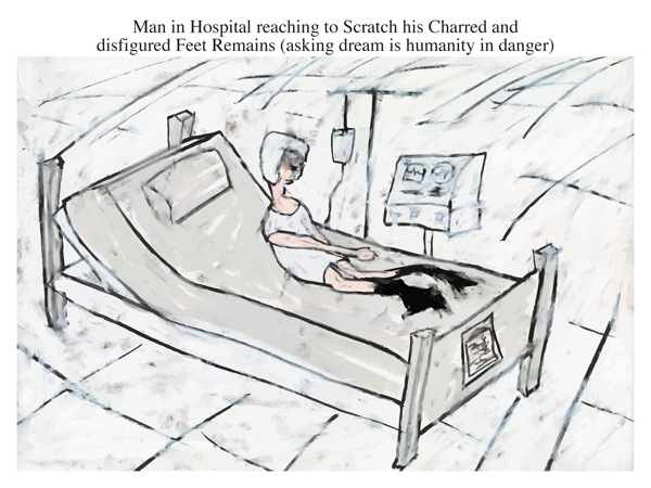 Man in Hospital reaching to Scratch his Charred and disfigured Feet Remains (asking dream is humanity in danger)
