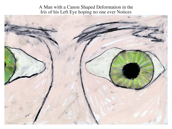 A Man with a Canon Shaped Deformation in the Iris of his Left Eye hoping no one ever Notices
