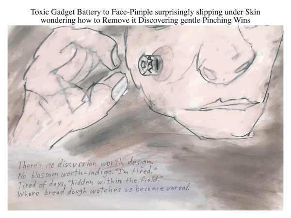 Toxic Gadget Battery to Face-Pimple surprisingly slipping under Skin wondering how to Remove it Discovering gentle Pinching Wins